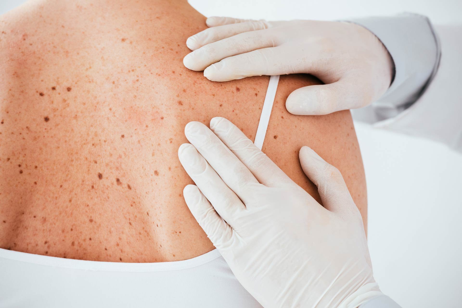 dermatologia-imq-zurriola